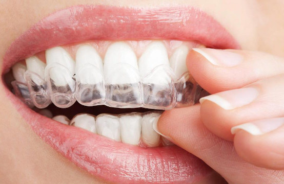 beljenje zuba