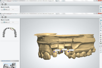 cad cam stomatologija